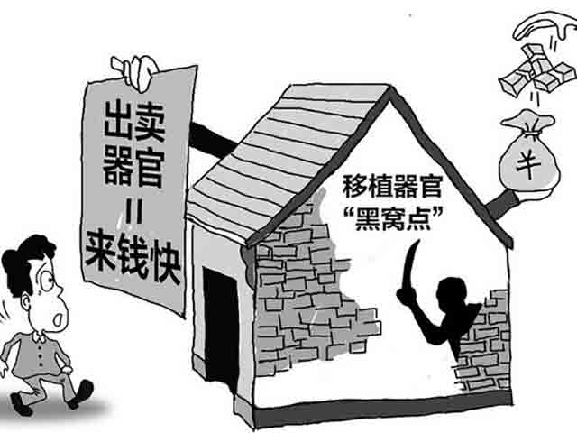 出售自己的器官违法吗